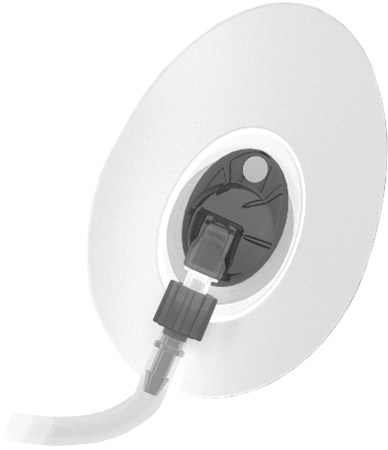 Prospera Propel FX Dome